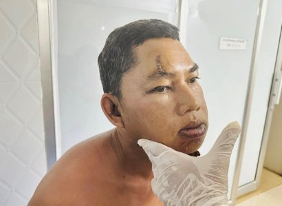 Hospitalized activist says he’ll join Cambodia’s ruling party – if he gets justice